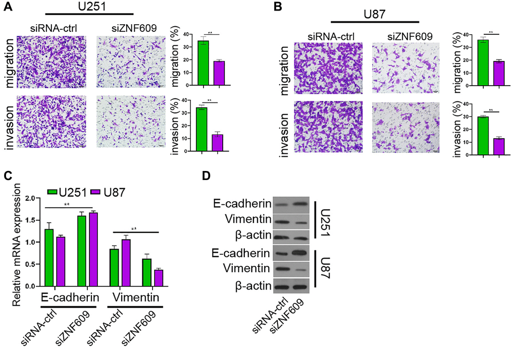 The depletion of ZNF609 represses glioma cell invasion in vitro. (A–D) The U251 and U87 cells were transfected with ZNF609 siRNA. (A and B) The cell invasion and migration were detected by transwell assays. (C) The mRNA of E-cadherin and Vimentin was analyzed by qPCR. (D) The protein levels of E-cadherin and Vimentin were determined by Western blot analysis. mean ± SD, **P 