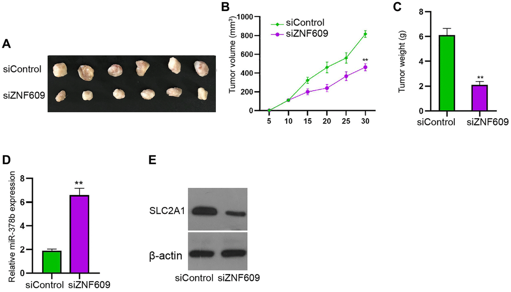 ZNF609 attenuates glioma cell growth in vivo. (A–E) The tumorigenicity analysis was conducted in nude mice injected with U251 cells treated with ZNF609 siRNAs. The tumor tissue images (A), tumor volume (B), and tumor weight (C) were demonstrated. The expression of miR-378b was measured by qPCR (D) and SLC2A1 expression was detected by Western blot analysis (E). mean ± SD, **P 