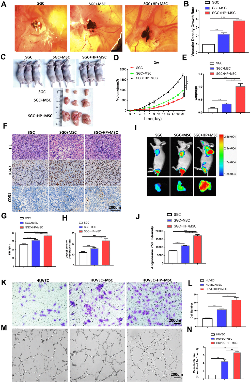 BM-MSCs promote the angiogenesis of GC in vivo and the tube formation and migration of HUVECs in vitro following H. pylori stimulation. (A) Representative images of the blood vessels of SGC co-injected with or without BM-MSCs or H. pylori -pretreated BM-MSCs in the CAM assay over 4 days. n= 10 eggs in each group. (B) Quantification of the vascular density growth rate in the CAM assay. (C, D) SGC cells mixed with or without BM-MSCs or H. pylori-pretreated BM-MSCs were injected into BALB/c nude mice, and tumor volumes were monitored every two days. n= 3 mice in control group and 5 mice per group in other groups (E) Average tumor weights from nude mice. (F) Representative images of H&E staining and Ki-67 and CD31 (PECAM1) IHC staining of tumors. (G, H) Quantification of Ki-67 and CD31. (I) Angiogenesis fluorescent agent AngioSense 750EX in tumors. (J) Quantification of I. (K) The migration ability of HUVECs was evaluated using a Transwell assay. n= 3 wells per group. (L) Quantification of K. (M) In vitro tube formation to investigate the effect of CM from BM-MSCs on HUVEC tube formation. n= 5 wells per group. (N) Quantification of M.