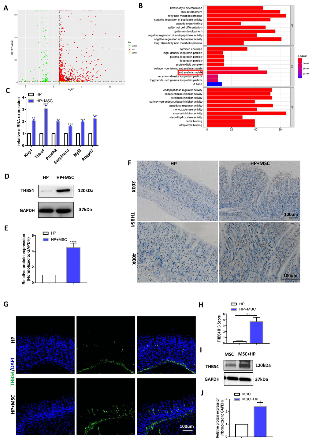 BM-MSC engraftment leads to THBS4 overexpression during H. pylori infection. (A) Volcano plot presentation of differentially expressed genes of gastric tissues in H. pylori versus H. pylori+ MSCs mice. (B) Enrichment analysis of differential genes. (C) RT-PCR verified the expression of differential genes associated with angiogenesis. THBS4 was the most highly expressed gene. n= 10 mice in each group. (D, E) Western blot analysis showed that BM-MSC transplantation led to THBS4 overexpression. n= 3 mice in each group. (F, G) IHC (F) and IF (G) of THBS4 in H. pylori+ MSCs or H. pylori mice. n= 3 mice per group Cell nuclei, DAPI. THBS4, FITC. Magnification: × 200 and × 400. (H) Quantification of F. (I, J) Western blot analysis of THBS4 revealed that H. pylori pretreatment increased the protein expression of THBS4 in BM-MSCs. n= 3 wells per group.