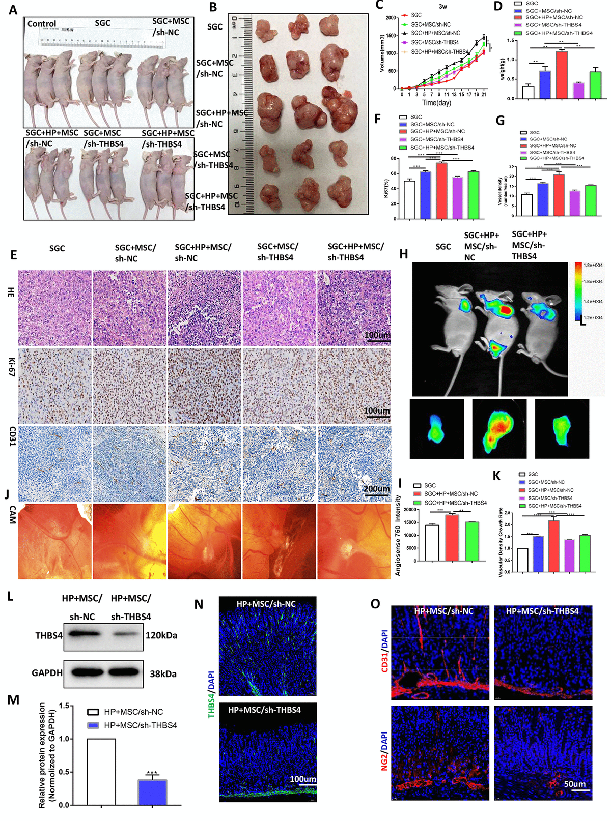 THBS4 mediates BM-MSC-induced promotion of GC angiogenesis in vivo. (A, B) Four-week-old nude male mice were injected with either SGC cells only or SGC and BM-MSCs transfected with recombinant lentiviral vectors. Three weeks following injection, the mice were euthanized, and the tumors were analyzed. n= 3 mice in control group and 5 mice per group in other groups. (C) Growth curve of tumors described in A. (D) Tumor weight of injected tumors at end-point. (E) H&E staining and Ki-67 and CD31 immunostaining of tumors described in A. (F, G) Quantification of staining presented in E performed with Image Plus. (H, I) Following AngioSense 750EX injection, tumor vascular permeability fluorescence imaging in vivo was performed to detect the neovascularization density of tumors in A. (J, K) Representative images and quantification of the CAM assay. n= 5 eggs in each group. (L, M) Western blot analysis of THBS4 in gastric tissues after NC BM-MSC or THBS4-knockdown BM-MSC transplantation. n= 3 mice in each group. (N) IF of THBS4 in gastric tissues after NC BM-MSC or THBS4-knockdown BM-MSC transplantation. (O) IF of CD31 and NG2 in gastric tissues in NC BM-MSC-transplanted mice and THBS4-knockdown BM-MSC-transplanted mice. n= 10 mice in each group.