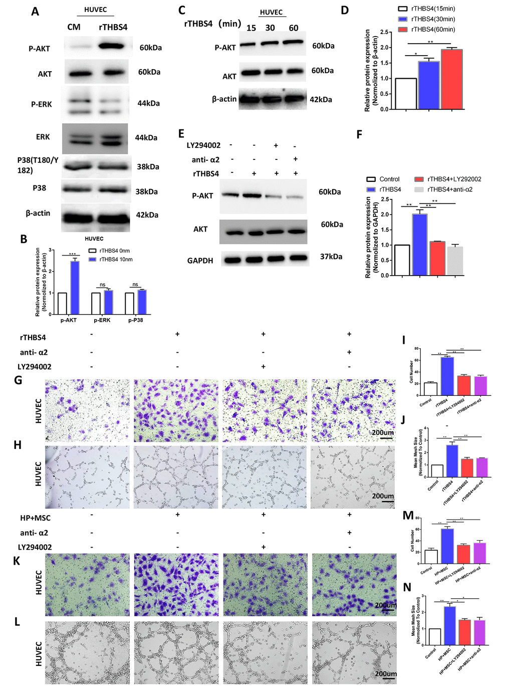 Activation of AKT by THBS4/integrin α2 axis in HUVECs. (A, B) rTHBS4 induced the phosphorylation of AKT in HUVECs. n= three independent experiments. The HUVECs were treated with and without rTHBS4 for 1h and the whole cell lysates were analyzed by WB for levels of downstream kinases. (C, D) p-AKT activation occurred in a time-dependent manner in rTHBS4-treated cells. n= three independent experiments. (E, F) The HUVECs were treated with rTHBS4 for 1h in the presence of integrin α2-specific antibody or PI3K inhibitor LY294002. Western blot analysis showed that rTHBS4 increased Akt phosphorylation in HUVECs, while this effect was alleviated by blocking integrin α2 or inhibiting Akt. n= three independent experiments. (G) Transwell migration assay to investigate the effect of PI3K inhibition and integrin α2 blockade on HUVEC migration after treatment with rTHBS4. n= 3 wells per group. (H) In vitro tube formation to investigate the effect of PI3K inhibition and blocking integrin α2 on HUVEC tube formation. n= 3 wells per group. (I) Quantification of G. (J) Quantification of H. (K, L) The CM from BM-MSCs stimulated by H. Pylori was applied to HUVECs in the presence or absence of integrin α2-specific antibody or PI3K inhibitor LY294002 for Transwell migration assay and tube formation assay. n= 3 wells per group. (M) Quantification of K. (N) Quantification of L.