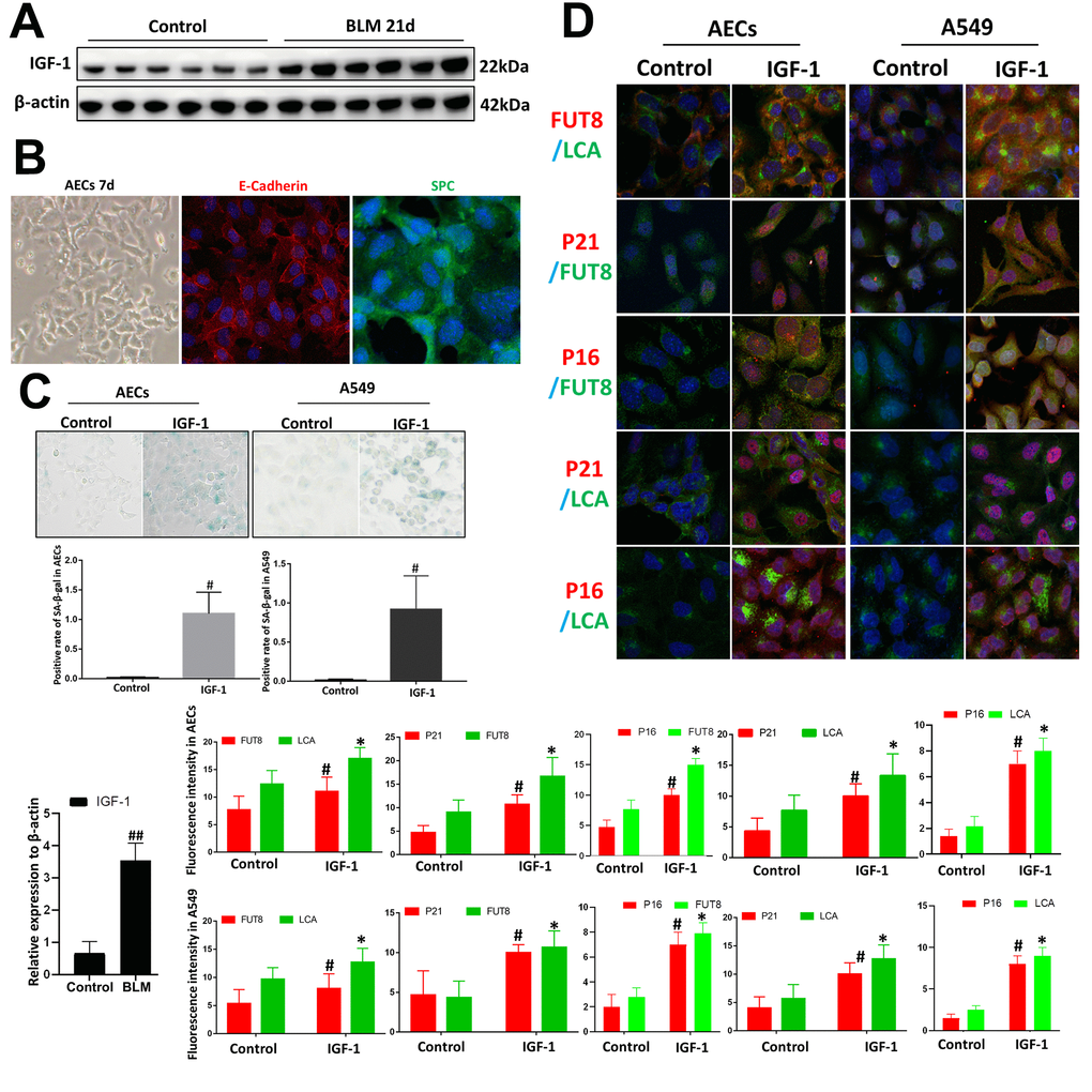 Core fucosylation was increased during the IGF1-induced AEC senescence in vitro. Primary cultures of AECs and A549 cells were incubated with IGF-1 (10 ng/ml) for 72 h. (A) The level of IGF1 was assessed using western blotting in different groups. (B) Representative bright-field images in AECs, and representative images of E-cadherin (red), SPC (green) staining is shown (original magnification, 200×). (C, D) SA-β-gal staining and representative images of dual staining for LCA (green) and FUT8 (red), FUT8 (green) and P21 (red), FUT8 (green) and P16 (red), LCA (green) and P21 (red) and LCA (green) and P16 (red) were performed to detect cellular senescence (original magnification, 200×). Data are shown as the mean ± SEM, n ≥ 3 per group. ##P P P 