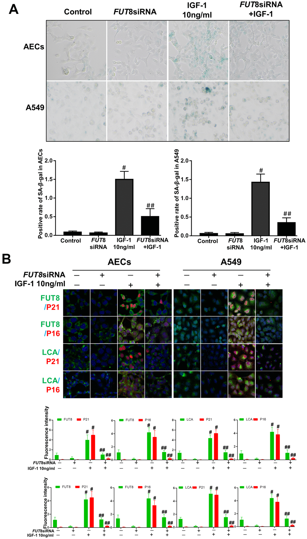 AEC senescence was inhibited upon FUT8 knockdown in vitro. (A) SA-β-gal staining was performed to detect cellular senescence of different groups (original magnification, 200×). (B) Representative images of dual staining for FUT8 (green) and P21 (red) staining, FUT8 (green) and P16 (red) staining, LCA (green) and P21 (red) staining and LCA (green) and P16 (red) staining are shown in vitro (original magnification, 200×). Data are shown as the mean ± SEM, n ≥ 3 per group. #P P FUT8 siRNA+ IGF1 group with the IGF1 group. One-way ANOVA followed by Dunnett’s Multiple Comparison Test.