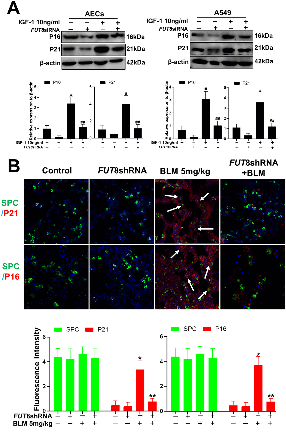 AEC senescence was inhibited upon FUT8 knockdown in vitro and vivo. (A) P21 and P16 levels were assessed using western blotting analyses in different groups. (B) Representative immunofluorescence images of dual staining for SPC (green) and P21 (red), SPC (green) and P16 (red) are shown in vivo (original magnification, 200×). Data are shown as the mean ± SEM, n ≥ 3 per group. #P P P P FUT8 siRNA+ IGF1 group with the IGF1 group. *indicates the comparison of the control group with the BLM group; **indicates the comparison of the FUT8shRNA+ BLM group with the BLM group. One-way ANOVA followed by Dunnett’s Multiple Comparison Test.