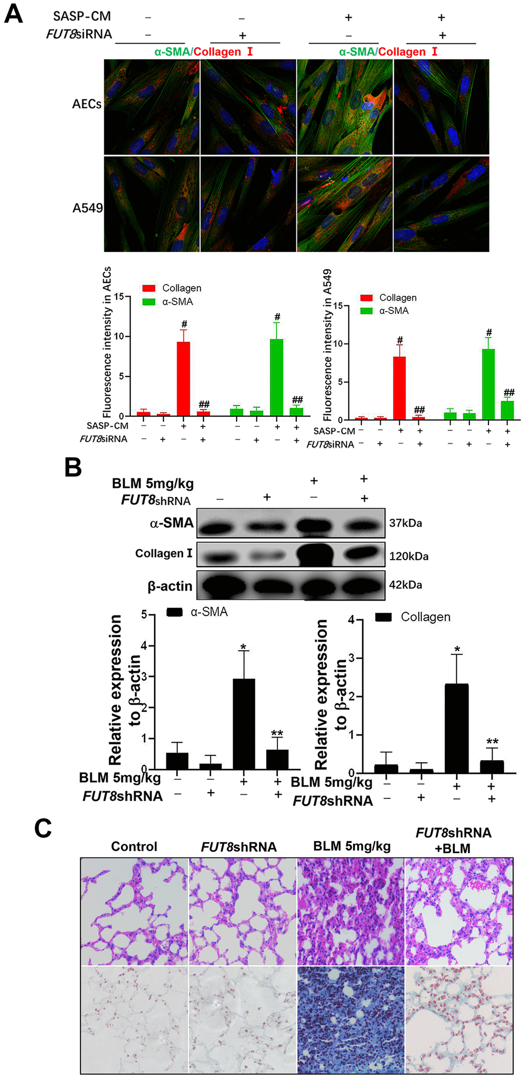 The fibroblast transition into myofibroblasts induced by the supernatants of senescent AECs can be inhibited by FUT8 knockdown. (A) After IGF1 was added to induce AEC senescence for 72 h, the medium was replaced by fresh medium without IGF1 to culture for another 3 days, then the supernatants were collected to culture MRC5 cells. The expression of α-SMA (green) and collagen I (red) were investigated using immunofluorescence (original magnification, 200×). (B) The expression of fibrotic markers, α-SMA and collagen I, were investigated by western blotting in vivo. (C) Representative images of HE and Masson’s trichrome-stained BLM lung sections (original magnification, 200×). #P P FUT8siRNA+ SASP-CM group with the SASP-CM group. *P P FUT8shRNA+BLM group with the BLM group. Data are shown as the mean ± SEM, n ≥ 3 per group. One-way ANOVA followed by Dunnett’s Multiple Comparison Test.