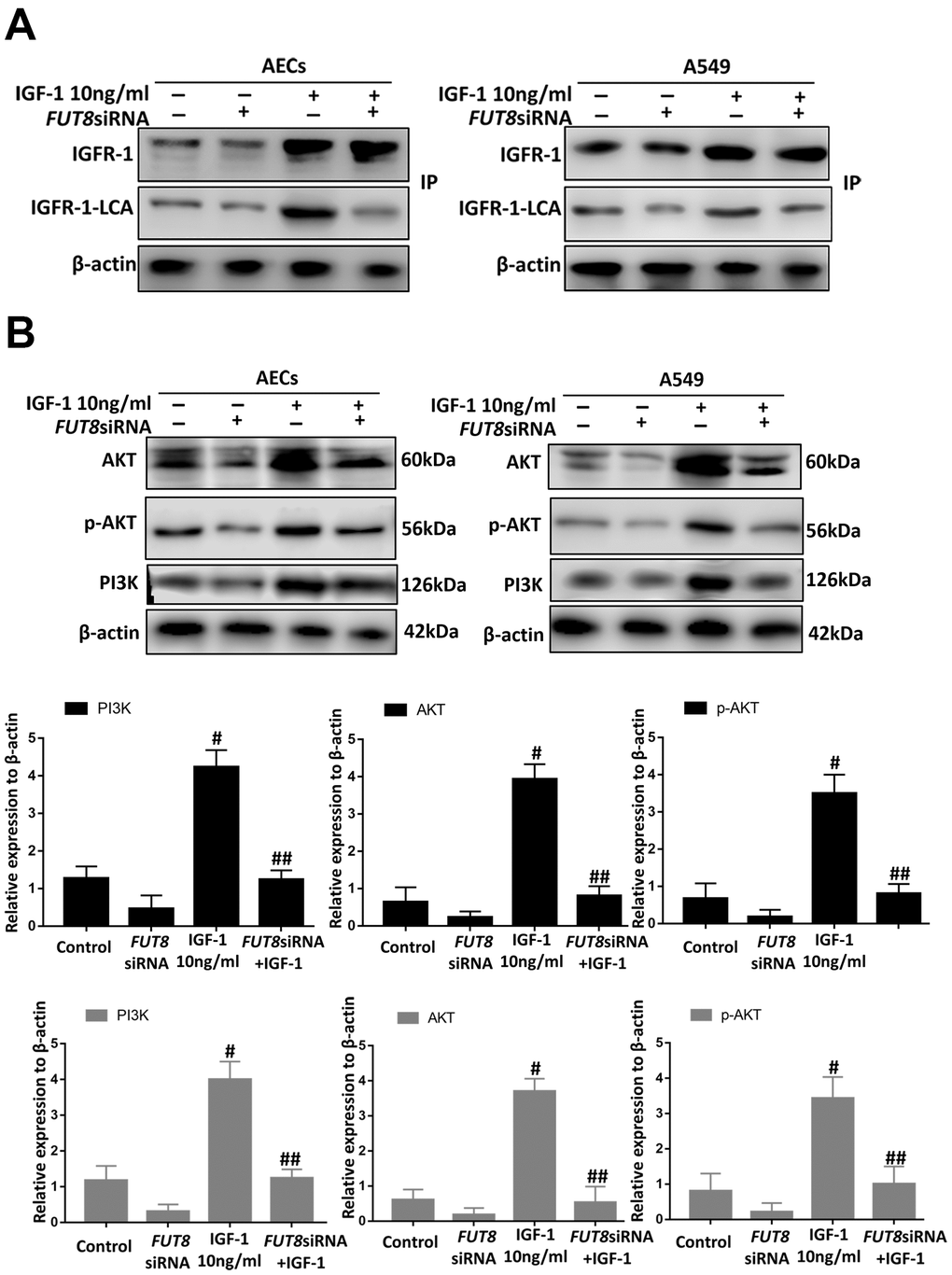 CF regulates AEC senescence through the IGF1/PI3K/AKT pathways in vitro. (A) The IGFR-1 level in total cell lysates was assessed using western blotting analyses. Lectin blot analysis of the immunoprecipitated IGFR-1 protein. IGFR-1 was immunoprecipitated from whole cell lysates using anti-IGFR-1 antibodies. The blots were probed with LCA. Representative data are shown. Quantification is shown in the lower panel. (B) PI3K, AKT and p-AKT levels were assessed using western blotting analyses. Total cell lysates were subjected to immunoblotting. #P ##P # indicates the comparison of the control group with the IGF1 group; ## indicates the comparison of the FUT8siRNA+ IGF1 group with the IGF1 group. One-way ANOVA followed by Dunnett’s Multiple Comparison Test. Each experiment was performed in triplicate.