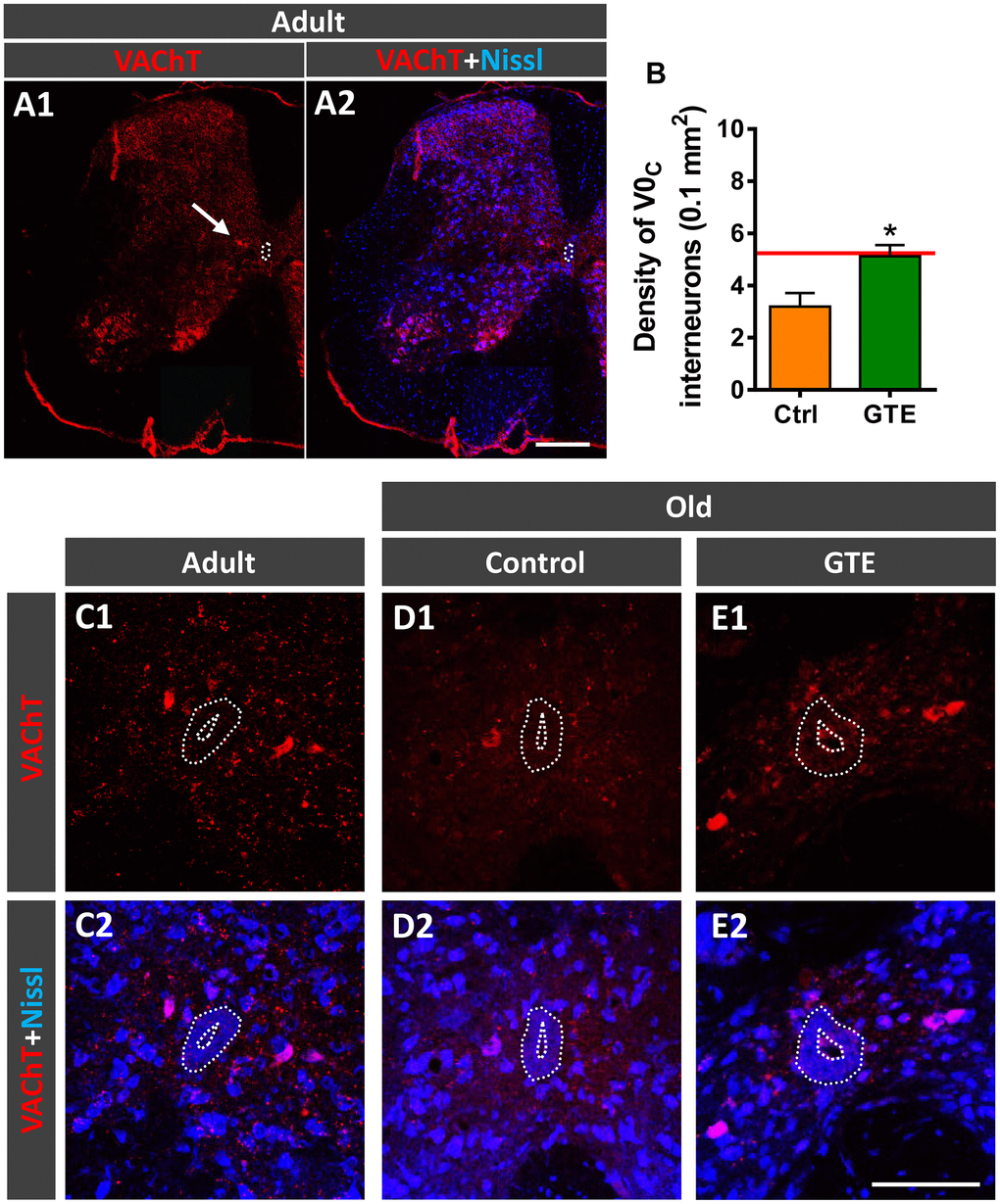 GTE-supplemented diet prevents the age-related loss of V0C interneurons. (A1, A2) A general view of a spinal cord hemisection of an adult mouse immunolabeled for VAChT (red) and counterstained with fluorescent Nissl (blue) for neuron identification; the arrow points to a V0C interneuron cluster located near the central canal (delimited by a dotted line); note also the different VAChT-positive MN pools in the ventral horn. (B) Density of V0C interneurons in spinal cords of aged animals from control and GTE groups; bars represent the mean ± SEM of 3-5 animals (20-28 images) per condition; *p 6]. (C1–F2) Representative confocal micrographs of VAChT-positive V0C interneurons (red) in the spinal cords of an adult mouse (C1, C2) and of old animals fed with the control (D1, D2) and GTE-supplemented diet (E1, E2); sections were counterstained with fluorescent Nissl (blue) for neuron visualization; the central canal is delimited by dotted lines. Scale bars: in A2 = 200 μm (valid for A1), and in E2 = 100 μm (valid for C1–E1).