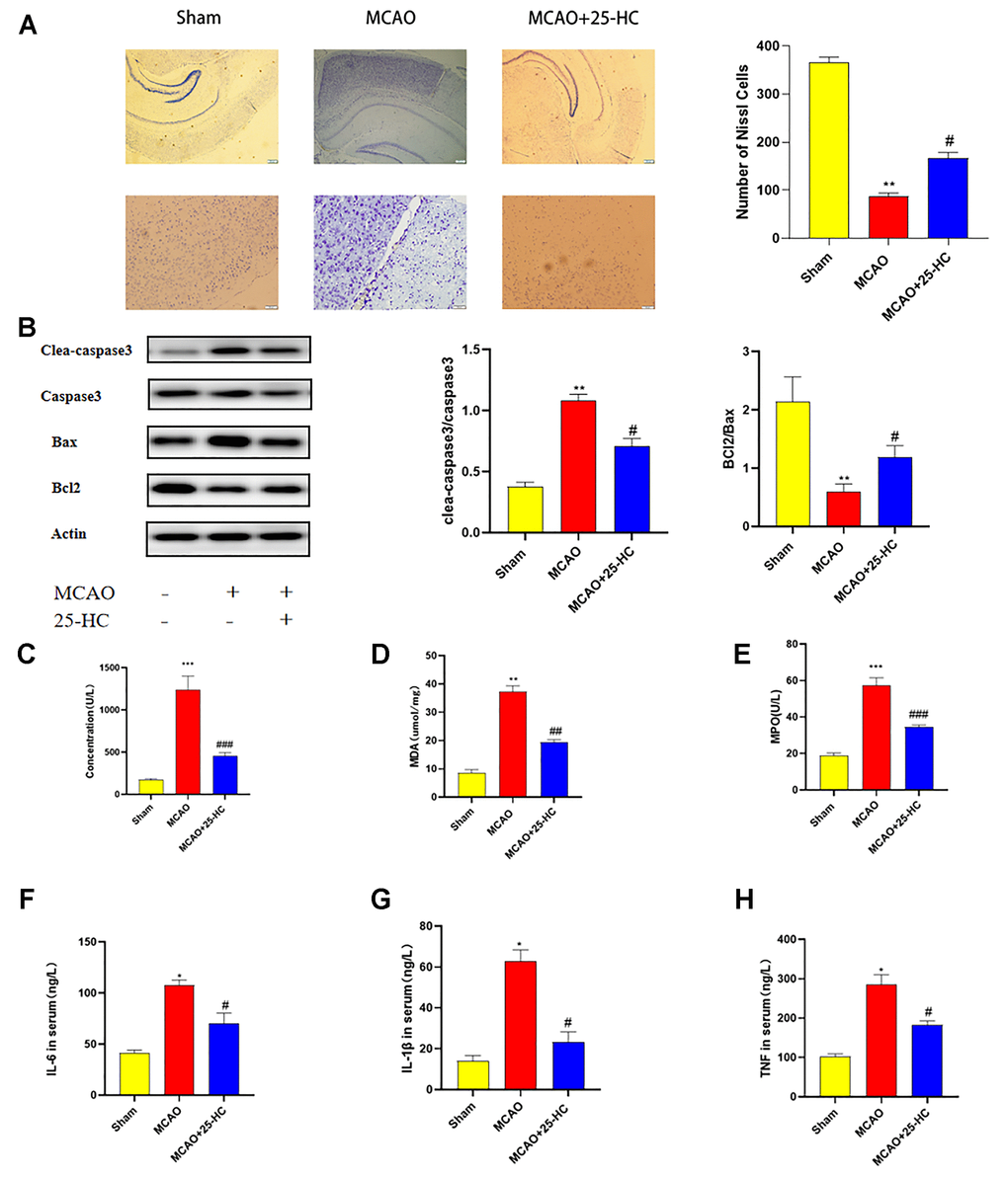 25-Hydroxysterol reduces brain tissue apoptosis and oxidative damage and inflammation in mouse middle cerebral artery occlusion (MCAO) model. (A) Nissl staining 40× and 200× (scale bar = 50 μm/200 μm, N = 4 per group). (B) Western blots were used to detect the expressions of caspase-3, cleaved caspase-3, Bcl2, and Bax. (C–H) Serum levels of interleukin (IL-6), IL-1β, and tumor necrosis factor-α were detected by commercially available ELISA kits. Myeloperoxidase (MPO), malondialdehyde (MDA), and lactate dehydrogenase (LDH) levels in the serum were quantified by using commercial kits following instructions of the manufacturer. (N = 6 per group, **PPP