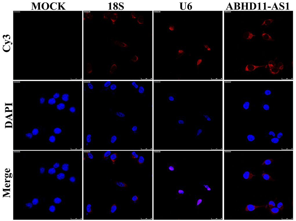 ABHD11-AS1 was mainly localized in the cytoplasm. Subcellular localization of ABHD11-AS1 determined by RNA FISH assay, U6 and 18s rRNA were used as internal controls.