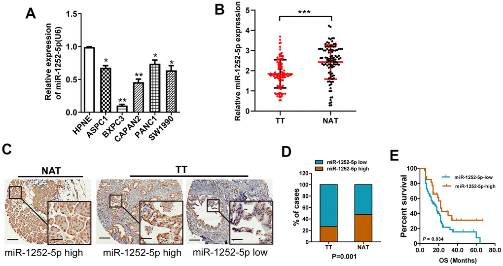 MiR-1252-5p expression in PAC cell lines and tissue samples. (A) qRT-PCR assay analyses of miR-1252-5p expression in five human PAC cell lines and HPNE. (B) qRT-PCR assay analysis of miR-1252-5p expression in 102 matched fresh human TT and NAT pancreas samples. Data were obtained using the 2-ΔΔCT method and were normalized to U6 levels. (C, D) In situ hybridization assay and staining score analyses were used to determine miR-1252-5p expression levels in 102 matched human TT and NAT pancreas samples. Scale bar, 200μm; scale bar for inserts, 40μm. (E) Kaplan-Meier survival curves showed association of miR-1252-5p expression with overall survival in patients with PAC (P = 0.034, log-rank test). PAC, pancreatic cancer; TT, tumor tissues; NAT, non-cancerous adjacent tissues. *, PP P 