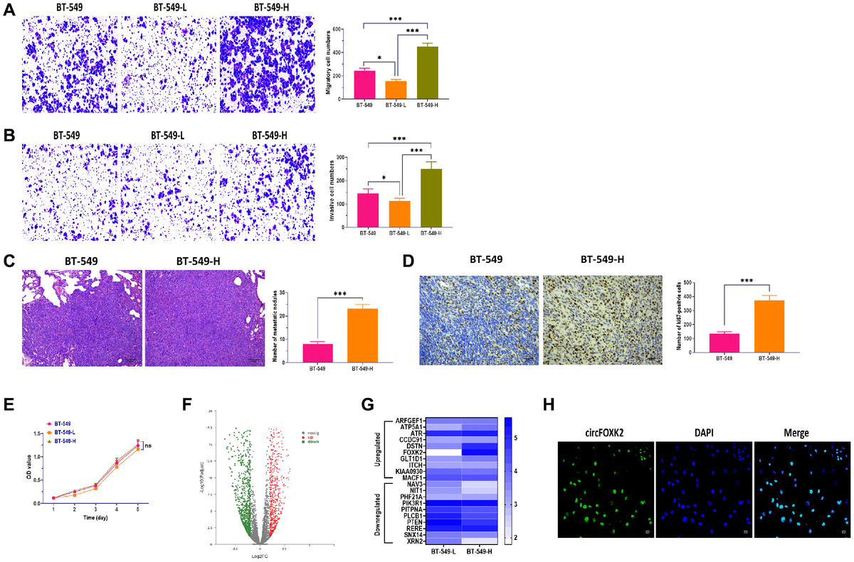 CircFOXK2 is upregulated in highly metastatic BC cells. (A) Migration ability of BT-549 cells with high and low potential of metastasis (BT-549-H and BT-549-L). Scale bar: 20 μm. (B) Invasion ability of BT-549 cells with high and low potential of metastasis (BT-549-H and BT-549-L). Scale bar: 20 μm. (C) Lung metastasis of mice injected with BT-549 or BT-549-H cells through the tail vein, as determined by H&E stain. Scale bar: 100 μm. (D) The expression of Ki67 in lung tissues of mice injected with BT-549 or BT-549-H cells through the tail vein, as determined by IHC assay. Scale bar: 40 μm. (E) Cell viability of BT-549-H and BT-549-L cells. (F) Volcano plot of differentially expressed circRNAs between BT-549-H and BT-549-L cells. (G) Heatmap for expressions of top 10 upregulated and downregulated circRNAs between BT-549-H and BT-549-L cells. (H) Cellular distribution of circFOXK2 in BT-549 cells, as detected by RNA FISH assay. Data were represented as mean ± SD. Each experimental group had at least three replicates. *p **p ***p 