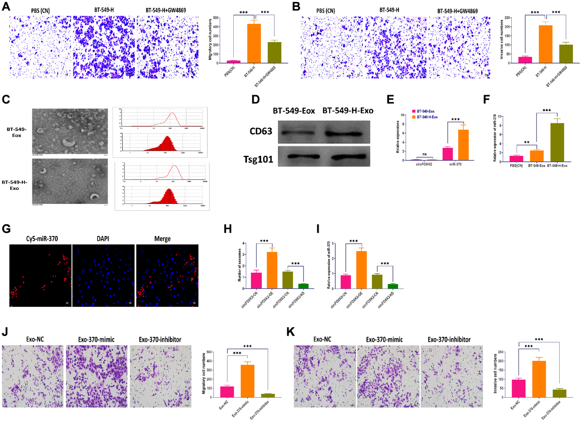 Exosomal miR-370 derived from BT-549-H promote BC metastasis. (A) Migration ability of BT-549 cells cocultured with BT-549-H cells or BT-549-H plus GW4869 treatment. Scale bar: 20 μm. (B) Invasion ability of BT-549 cells cocultured with BT-549-H cells or BT-549-H plus GW4869 treatment. Scale bar: 20 μm. (C) Morphology and size distribution of exosomes derived from BT-549 (BT-549-Exo) or BT-549-H (BT-549-H-Exo) cells, as determined by transmission electron microscopy, nanoparticle tracking analysis. (D) Expressions of exosomal markers CD63 and Tsg101, as detected by Western blotting. (E) Expressions of circFOXK2 and miR-370 in BT-549-Exo and BT-549-H-Exo. (F) Expression of miR-370 in BT-549 cells treated with BT-549-Exo and BT-549-H-Exo. (G) Exosomal miR-370 was taken up by recipient BT-549 cells, as determined by fluorescence staining assay. Scale bar: 20 μm. (H) Number of exosomes in BT-549 cells with overexpression or knockdown of circFOXK2. (I) Expression of exosomal miR-370 in BT-549 cells with overexpression or knockdown of circFOXK2. (J) Migration ability of BT-549 cells treated with exosomes containing miR-370 mimic or inhibitor. Scale bar: 20 μm. (K) Invasion ability of BT-549 cells treated with exosomes containing miR-370 mimic or inhibitor. Scale bar: 20 μm. Data were represented as mean ± SD. Each experimental group had at least three replicates. *p **p ***p 
