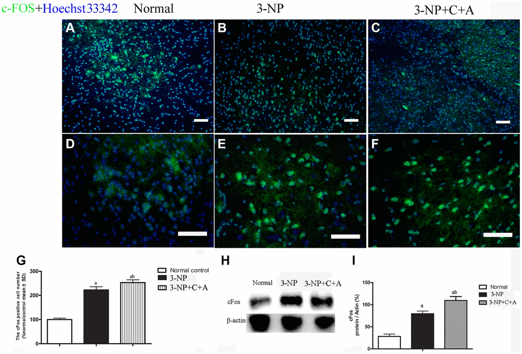 (A–G): Immunofluorescence staining images of c-FOS (green, immediate early gene, a marker of neuronal activation, (A–C) at magnification ×100 and (D–F) at magnification ×200. Cell nuclei were stained with Hoechst33342 dye (blue). (G) Semi-quantitative profiles showed elevated c-Fos expression in the 3-NP+vehicle group and a further increase in c-Fos levels with C16+Ang-1 treatment. Scale bar = 100 μm. Western blot images (H–I) of the levels of c-Fos in the control, 3-NP, and 3-NP+C16+Ang-1 groups showed a similar trend. aP bP 