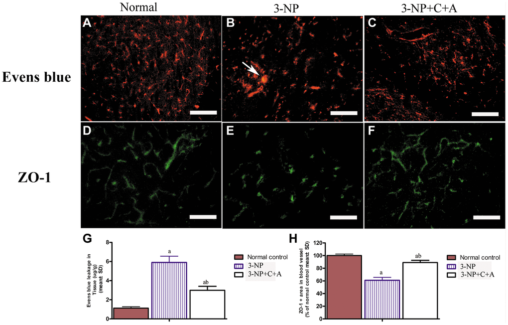 (A–F) Treatment with C16+Ang-l can alleviate 3-NP-induced permeability of the blood-brain barrier (leakage of Evans Blue dye, red) and loss of tight junctions (ZO-1 immunostaining, green) in the (A, D) control, (B, E) 3-NP, and (C, F) 3-NP+C16+Ang-1 groups. Scale bar = 100 μm. (G, H) Semi-quantitative profiles of (G) Evans Blue staining and (H) ZO-1 immunostaining. aP bP 