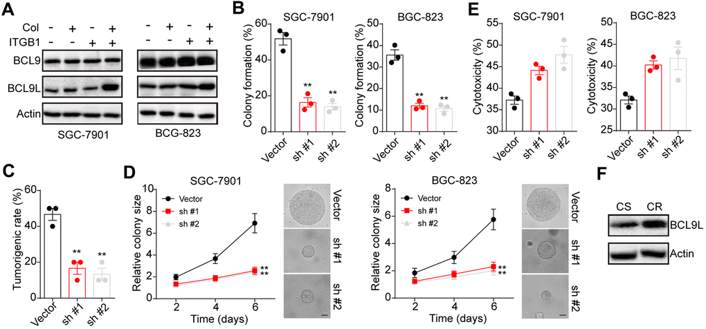 BCL9L was up-regulated in 3D collagen cultured ITGB1+ gastric cancer. (A) The ITGB1-/+ SGC-7901 cells were sorted and cultured in 3D collagen gel (6 days) or not. The expression of BCL9, BCL9L and β-actin was examined by western blotting. (B) The ITGB1+ SGC-7901 cells were sorted and cultured in 3D collagen gel (6 days). Then tumor cells were treated with BCL9L shRNA or vector and the 3D colony formation capability was examined. (C) The ITGB1+ SGC-7901 cells were sorted and cultured in 3D collagen gel (6 days). Then tumor cells were treated with BCL9L shRNA or vector and the tumorigenic capability was examined. (D) The colony sizes of tumor cells in (C). The scale bar is 30 μm. (E) The ITGB1+ SGC-7901 cells were sorted and cultured in 3D collagen gel (6 days). Then tumor cells were treated with BCL9L shRNA or vector. Then tumor cells were treated with 5-FU (5 μg/ml) and the cell apoptosis was examined. (F) Western blotting of BCL9L and β-actin in chemo-sensitive (CS) and chemo-resistant (CR) tissues from gastric patients. *Indicates P 