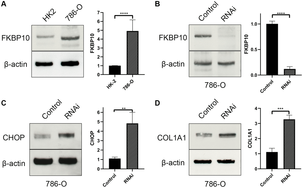 FKBP10 is high expressed and its inhibition causes ER stress in ccRCC. β-actin is set as loading control. Quantitative analysis of each study is presented in a bar graph. (A) Immunoblotting showed FKBP10 was high expressed in 786-O ccRCC cell line comparing with normal kidney HK-2 cell line. (B) FKBP10 RNAi efficacy was confirmed by immunoblotting. (C) After FKBP10 RNAi, ER stress marker CHOP was high expressed than negative control group. (D) After FKBP10 RNAi, collagen type I precursor COL1A1 aberrantly accumulated in ccRCC cells. Negative control group showed much less expression of COL1A1.