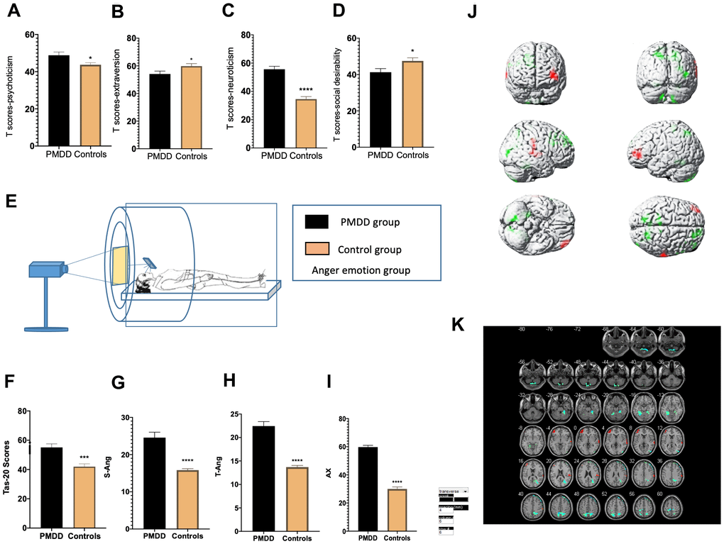 Comparisons of emotional changes and brain reactivity to emotional stimuli among PMDD vs. control study participants (PMDD=23, controls=23) of the anger-induced group. (A–D) Extraversion, psychoticism, neuroticism, and social desirability T-scores. (E) Schematic presentation of the study participants in the experiment. (F) TAS-20 scores for both groups. (G–I) Anger emotions in the anger-induced group. (J) Illustration of activations in various brain areas. Compared to the HC group, the PMDD group exhibited increased activation, mainly in the middle frontal gyrus (BA10), temporal lobe (BA42), main part of left cerebellum (BA37), as well as decreased activation in the precuneus (BA7), superior frontal gyrus (BA8), paracentral lobule (BA6), and right cerebellum (BA48). (K) PMDD group and HC group Anger mood Subtract Neutral Frontal Mid-Back Picture Condition T-test activation Differential area; p  389 warm (T value positive) represents PMDD group higher than the HC group, cool (T negative) on behalf of the normal group than the patient group.