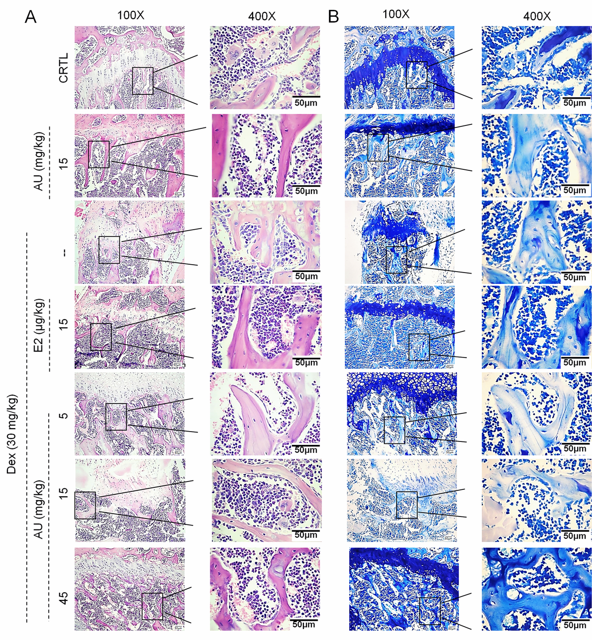 The effects of AU on the femoral histological changes of osteoporotic mice were detected by (A) H&E staining and (B) Giemsa staining (n=6).