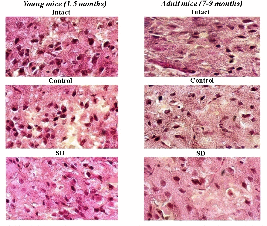 Representative images of histological samples of murine brain cortex after sleep deprivation modelling. Hematoxylin-eosin staining, magnification х20.