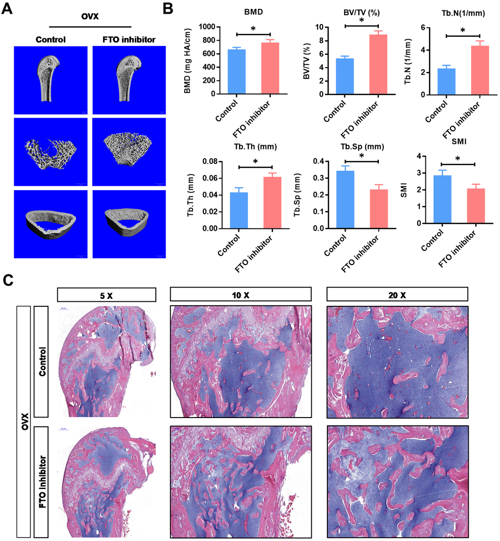 Inhibition of FTO promotes bone formation of OVX mice in vivo. (A) Representative images of μCT reconstructive images of tibial plateau in OVX groups with or without FTO inhibitor. (B) 3D structural parameters-BMD, BV/TV, Tb.N, Tb.Sp, Tb.Th and SMI-of tibial plateau by μCT in in OVX groups with or without FTO inhibitor. *PC) Representative hematoxylin-eosin staining images of tibial plateau showing bone volume in each group.