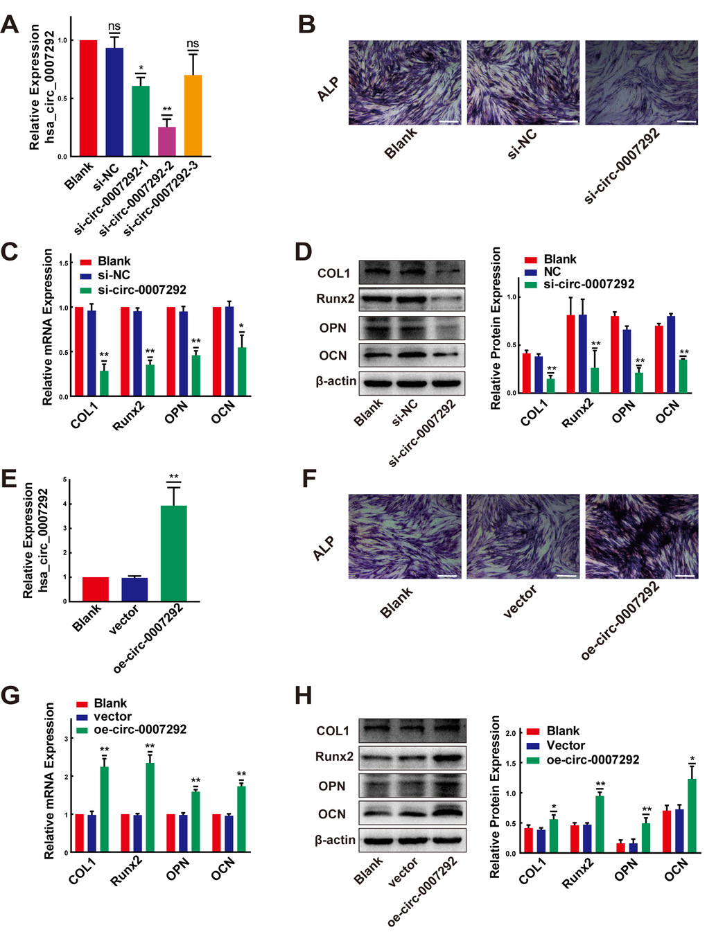 Hsa-circ-0007292 promotes the osteogenic differentiation of PLL cells. (A) qRT-PCR assays detected the transfection efficiency of siRNAs targeting hsa
