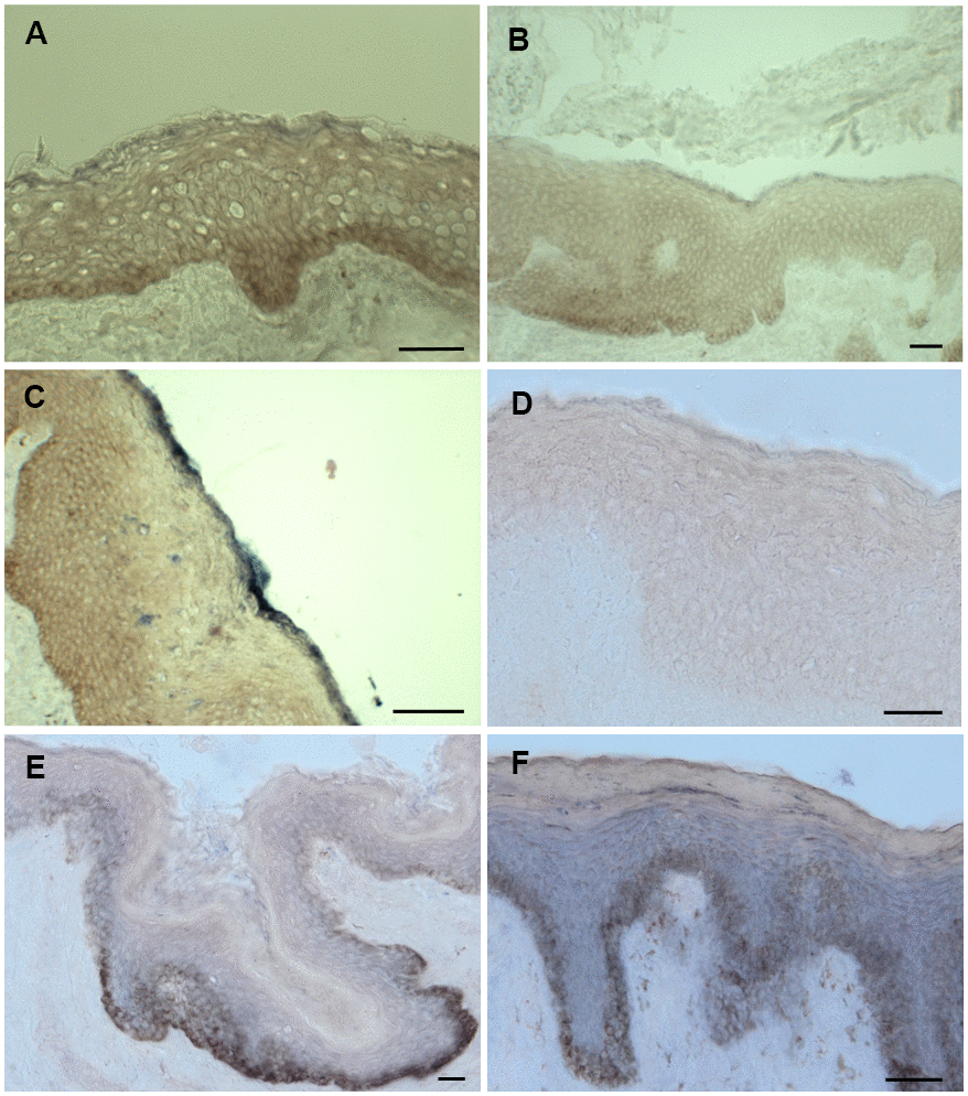 ISH staining of SPRR2c and mir542-5p. (A–C) ISH staining of SPRR2C. (A) Foreskin sample from a 6-year-old; (B) Foreskin sample of a 30-year-old; (C) Foreskin sample of a 61 year old. Increased SPRR2C levels were detected in old skin samples compared to young skin. (D–F) ISH staining of mir542-5p. (D) Foreskin sample of an eight-year old; (E) Foreskin sample of a 30-year-old; (F) Foreskin sample of a 61-year old. During aging the hsa-mir542-5p levels gradually increase. (B, E) as well as (C, F) are specimen from identical donors. The intensity of the black-purple staining correlates with the amount of either SPRR2C or mir-542-5p. Stratum basale appears brownish due to the presence of melanocytes and is no specific staining. Scale bar: 50 μm.