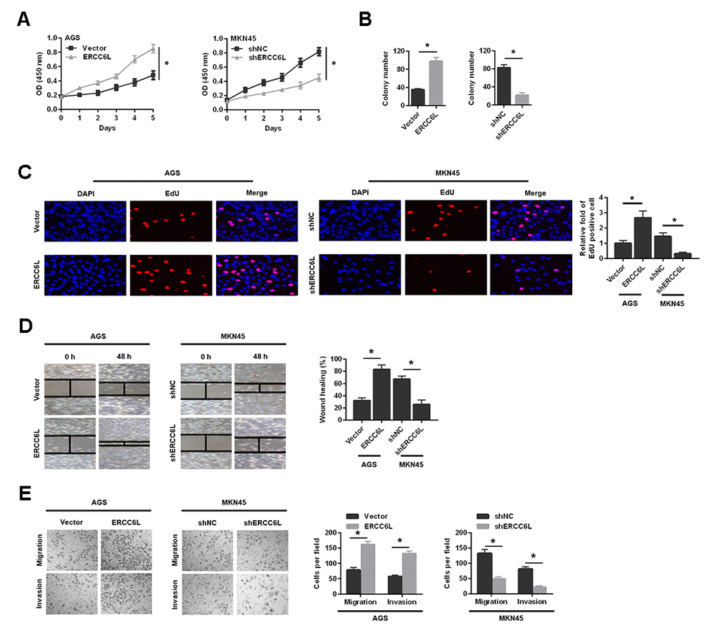 The effects of ERCC6L overexpression or knockdown on GC cells growth, migration and invasion in vitro. Following ERCC6L overexpression or knockdown treatment, CCK-8 assay (A), colony formation assay (B) and EdU assay (C) were used to evaluate the effects of ERCC6L expression on the proliferation ability of GC cells. The wound-healing assay (D), transwell migration and invasion assays (E) were employed to assess the effects of ERCC6L overexpression or knockdown on the migration and invasion ability of GC cells. *P 