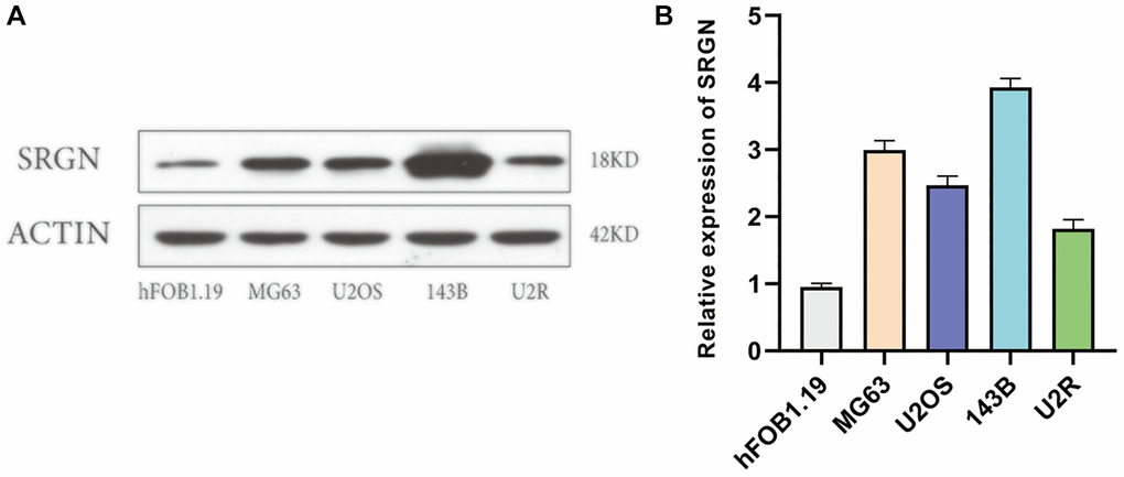 SRGN expression was upregulated in osteosarcoma cells. (A) Expression of SRGN by western blot in hFOB1.19 and osteosarcoma cells. (B) The expression level of SRGN in osteosarcoma cells was detected by quantitative polymerase chain reaction (qRT-PCR). Data are presented as mean ± SD. *P 