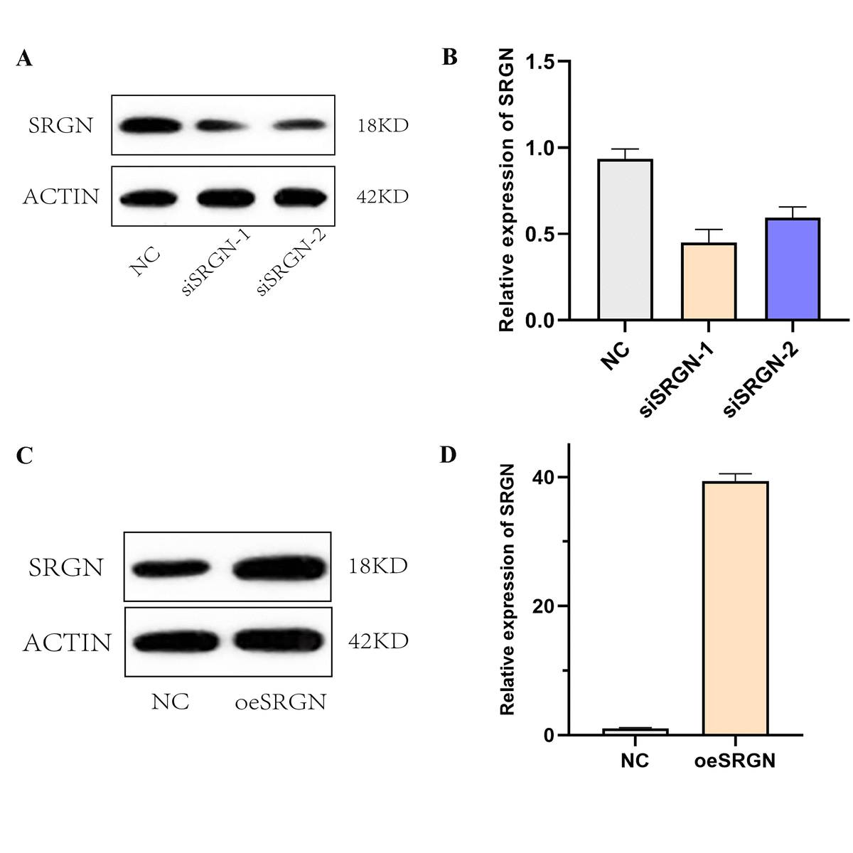Overexpression and knockdown efficiency of SRGN. (A) and (B). The interference efficiency of siRNA1 and siRNA2 against 143B was detected by Western blot and qRT-PCR, respectively. (C) and (D). The overexpression of SRGN at the protein level and mRNA level.