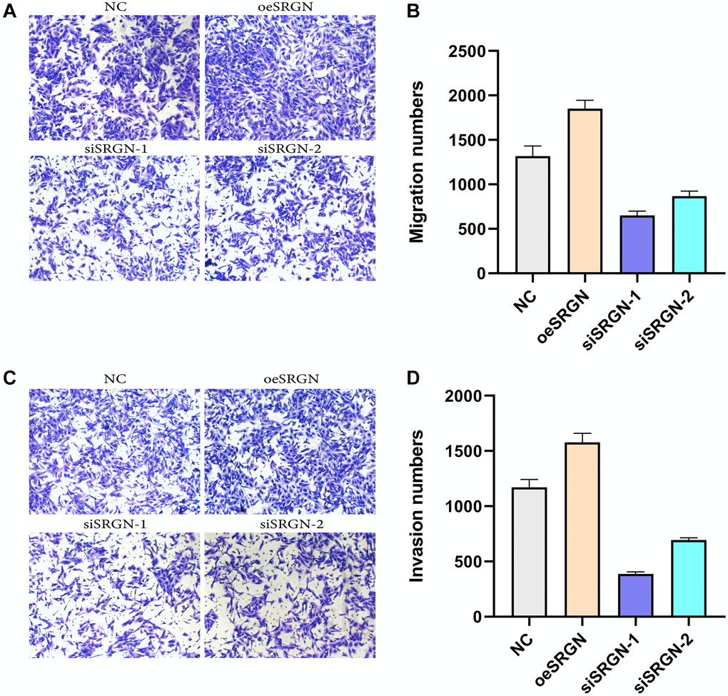 SRGN affects the migration and invasion of 143B cells. Transwell assays were used to detect the migration and invasion ability of 143B cells.