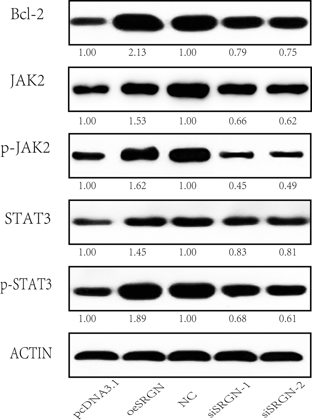 SRGN affects the JAK/STAT signaling pathway in 143B cells. Western blot analysis of the expression of Bcl-2, JAK2, p-JAK2, STAT3, p-STAT3, and ACTIN. pcDNA3.1, means MOCK transfection with pcDNA3.1, and it was used as the empty control of the overexpression group; NC, negative control used as the control for siRNA experiments; * We set the quantized value of pcDNA3.1 and NC to 1.00. The other quantized values were compared with their respective experimental groups.