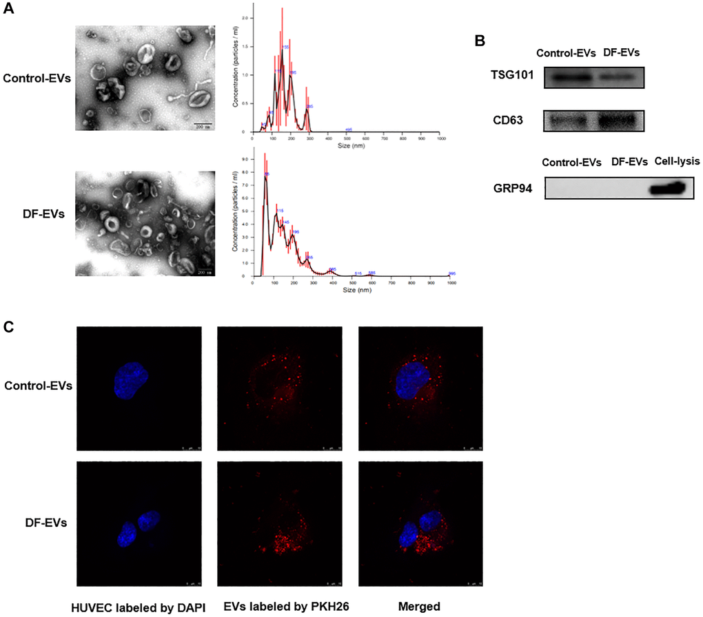 Characteristics of EVs derived from different wound fluids. (A) TEM analysis and NTA analysis of EVs. Scale bar: 200 nm. (B) EVs-related markers were detected by Western blotting. (C) EVs were labeled with PKH26 and co-incubated with HUVECs, and the representative images photographed by confocal microscope are showed above. Scale bar: 10 μm. At least three replicates of each experiment were performed.