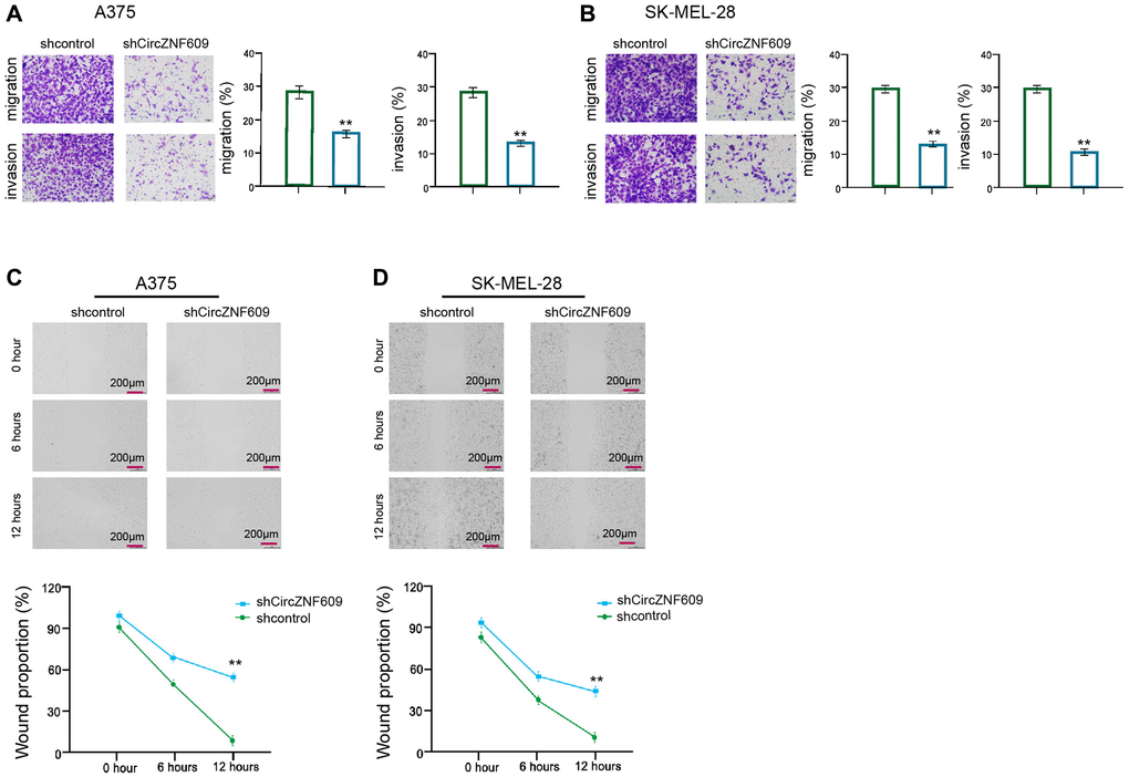 CircZNF609 enhances invasion and migration of melanoma cells. (A–D) The A375 and SK-MEL-28 cells were treated with the circZNF609 shRNA or control shRNA. (A and B) The cell migration and invasion were tested by transwell assays in the cells. (C and D) The migration and invasion were analyzed by wound healing assays in the cells. The wound healing proportion was shown. Data are presented as mean ± SD. Statistic significant differences were indicated: *P **P 