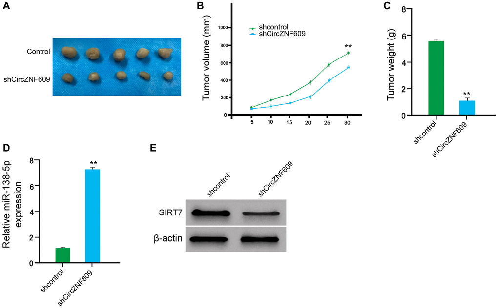 CircZNF609 promotes tumor growth of melanoma cells in vivo. (A–D) The impact of circZNF609 on tumor growth of melanoma cells in vivo was analyzed by nude mice tumorigenicity assay (n = 5). The A375 cells were treated with control shRNA or circZNF609 shRNA. (A) Representative images of dissected tumors from nude mice were shown. (B) The average tumor volume was calculated and presented. (C) The average tumor weight was calculated and presented. (D) The expression of miR-138-5p was measured by qPCR in the tumor tissues of the mice. (E) The expression of SIRT7was tested by Western blot analysis in the tumor tissues of the mice. Data are presented as mean ± SD. Statistic significant differences were indicated: *P **P 