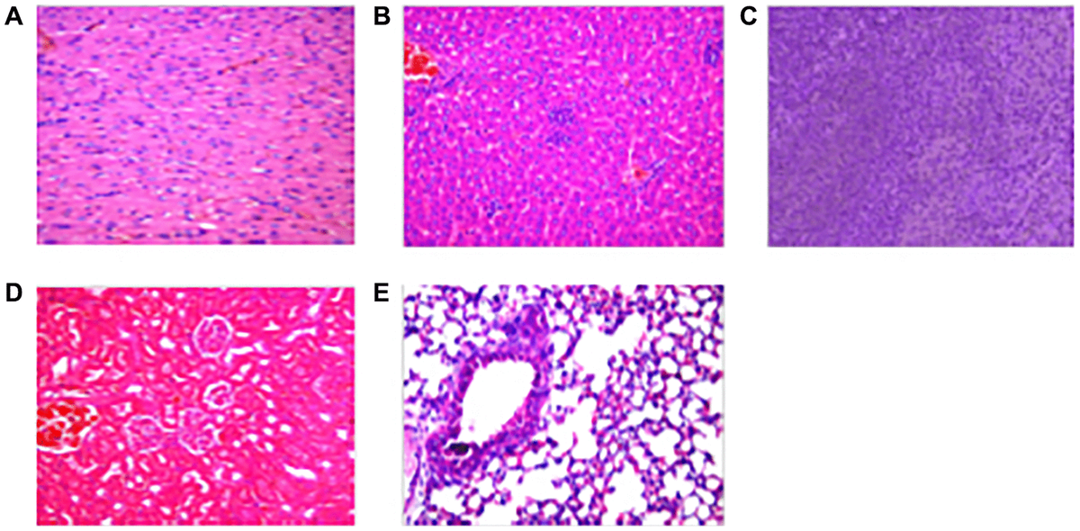 The effect of AWRK6/GO on mouse organs and tissues. Note: (A) Heart; (B) Liver; (C) Spleen; (D) Kidney; (E) Kidney.