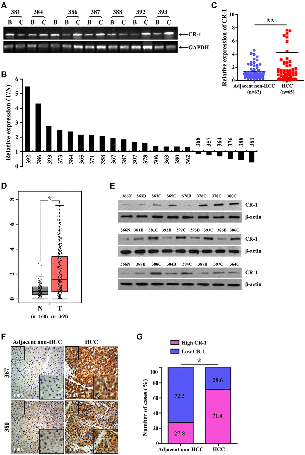 CR-1 expression is significantly upregulated in HCC tissues. (A) RT-PCR analysis of CR-1 transcript levels in HCC tissues (T) and matched adjacent non-tumor liver tissues (N). (B) The histogram plot shows ratio (T/N) of CR-1 mRNA levels in HCC (T) and matched non-tumor liver tissues (N) based on semi-quantitative analysis of RT-PCR data shown in Figure 2A. (C) qRT-PCR analysis shows relative levels of CR-1 transcript in 65 HCC (T) and 63 adjacent non-HCC liver tissue biopsies (N). (D) The expression levels of CR-1 transcript in HCC clinical specimens (T; n = 369) and non-cancerous liver tissue biopsies (N; n = 160) from TCGA datasets. (E) Representative western blot shows CR-1 protein expression levels in HCC (T) and adjacent non-HCC liver tissue biopsies (N). (F) Representative images show CR-1 protein expression in HCC and adjacent non-HCC liver tissue biopsies, as examined by IHC. (G) IHC assay analysis shows that CR-1 protein expression was significantly higher in majority of HCC tissues compared to the adjacent non-cancerous liver tissues (71.4% vs. 27.8%).