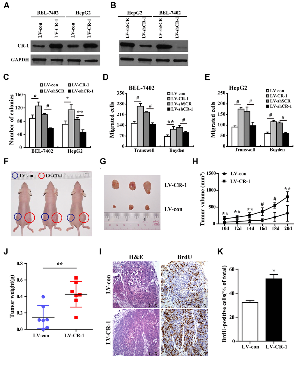CR-1 overexpression promotes in vitro proliferation, migration and invasion of HCC cells and in vivo xenograft HCC growth in nude mice. (A) Western blot analysis shows CR-1 protein expression in control (LV-con) and CR-1-overexpressing (LV-CR-1) BEL-7402 and HepG2 cells. (B) Western blot analysis shows CR-1 protein expression in scrambled control (LV-shSCR) and CR-1-silenced (LV-shCR-1) BEL-7402 and HepG2 cells. (C) Colony formation assay results show proliferation ability of CR-1-overexpressing and CR-1-knockdown HCC cells with their corresponding controls. The representative images of this assay are shown in Supplementary Figure 5. (D–E) Transwell migration and Boyden invasion assay results show the migration and invasion abilities of CR-1-overexpressing, CR-1-knockdown, and control BEL-7402 (D) and HepG2 (E) cells, respectively. (F) Representative pictures of nude mice bearing subcutaneous xenografts from LV-con (blue circle) or LV-CR-1 (red circle) transduced BEL-7402 cells. (G) Representative images of subcutaneous xenograft tumors formed from LV-con or LV-CR-1 transduced BEL-7402 cells. (H) Growth curve of xenograft tumor volumes derived from LV-con or LV-CR-1 transduced BEL-7402 cells. (I) The weights of xenograft tumors derived from LV-con or LV-CR-1 transduced BEL-7402 cells. (J) Representative images of H&E-stained and BrdU-stained sections of xenograft tumors derived from LV-con or LV-CR-1 transduced BEL-7402 cells. (K) The percentages of BrdU-positive cancer cells in xenograft tumors derived from LV-con or LV-CR-1 transduced BEL-7402 cells, as calculated by total number of BrdU-positive cells relative to total number of cancer cells.