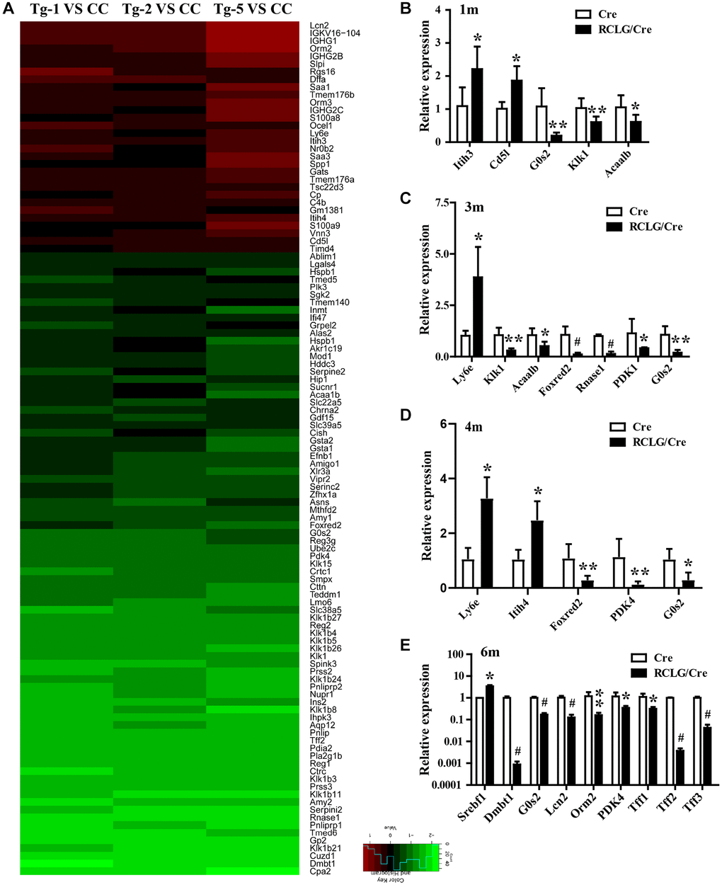 Microarray analysis reveals altered expression of HCC-related genes in the liver of RCLG/Alb-Cre mice. (A) Class comparison and hierarchical clustering of differentially expressed hepatocarcinogenesis-related genes in the livers of RCLG/Alb-Cre and Alb-Cre mice. Tg-1, Tg-2, and Tg-5 represent total RNA from the livers of three 4-month-old RCLG/Alb-Cre transgenic mice; CC represents pooled total RNA isolated from the livers of three 4-month-old Alb-Cre control littermates. Equal amounts of total RNA from the livers of each control mice were pooled to prepare CC; Tg-1, Tg-2 or Tg-5 vs. CC: Tg-1, Tg-2, or Tg-5 compared to pooled CC; Only genes showing a fold change of more than 2 and a Student’s t test P value of less than 0.05 were included in the analysis. Red indicates increased expression; blue indicates reduced expression. Other details of the microarray experiment are shown as in Supplementary Figure 7. (B–E) qRT-PCR analysis shows validation of 16 differentially expressed (increased or decreased mRNA expression) HCC-related genes from the microarray data in the RCLG/Alb-Cre and Alb-Cre mouse livers.