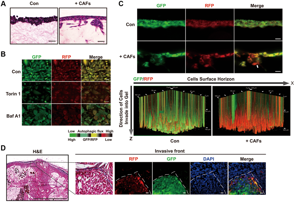 Autophagic degradation and recycling are elevated during the invading process. (A) H&E stained sections of 3D organotypic coculture gels. Scale bars, 50 μm. (B) The GFP/RFP ratio in single A549 cell colonies stable expressing the GFP-LC3-RFP-LC3ΔG cassette was determined under the indicated treatment. Scale bars, 200 μm. (C) Fluorescent images indicating GFP and RFP of A549 cells expressing GFP-LC3-RFP-LC3ΔG in cryosections of paraformaldehyde-fixed organotypic gels (upper panel) and GFP and RFP in a 3D volume rendering of live A549 cells expressing GFP-LC3-RFP-LC3ΔG (lower panel). White arrow, invasive front of A549 cells in the 3D organotypic coculture system. These fluorescent images of the gels in the 3D organotypic coculture system are representative of three independent experiments. Scale bars, 200 μm. The increments on the Z-axis indicate invasion distance (μm). (D) Representative images of H&E staining and GFP/RFP fluorescence in subcutaneous tumors formed by GFP-LC3-RFP-LC3ΔG-expressing A549 cells. Dashed line, tumor-stroma border. Scale bar, 200 μm for H&E staining and 50 μm for fluorescence images.