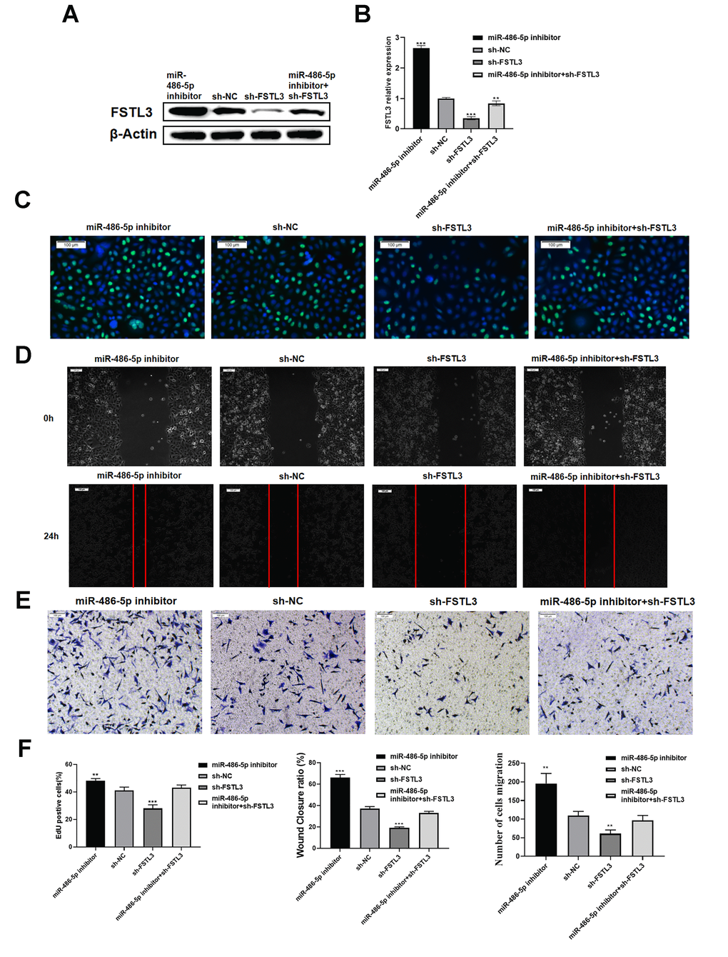 Evaluating miR-486-5p specificity for FSTL3 mRNA. (A) Western blotting evaluation of FSTL3 protein levels after transfection of sh-FSTL3 and/or miR-486-5p inhibitor into MGC-803 gastric cancer cells. Monitoring β-actin levels was used as an internal control in these blots. (B) Western blot results were quantified by using Image J software. Error bars indicate +SEM; significance indicated by asterisks, **PPC) Transfection of sh-FSTL3 and/or miR-486-5p inhibitor into MGC-803 gastric cancer cells and evaluation of cell proliferation using EdU assay (24h). (D) Wounded cell monolayer closure assay after transfection of sh-FSTL3 and/or miR-486-5p inhibitor followed by imaging at 8 and 24 h post-wounding. (E) The Transwell assay for cell migration after transfection of sh-FSTL3 and/or miR-486-5p inhibitor was into MGC-803 cells. Sh-NC construct (shRNA) is a negative control for FSTL3 knockdown. (F) Quantified results of EdU, wound healing and transwell migration assays. Sh-NC was analyzed as a control.