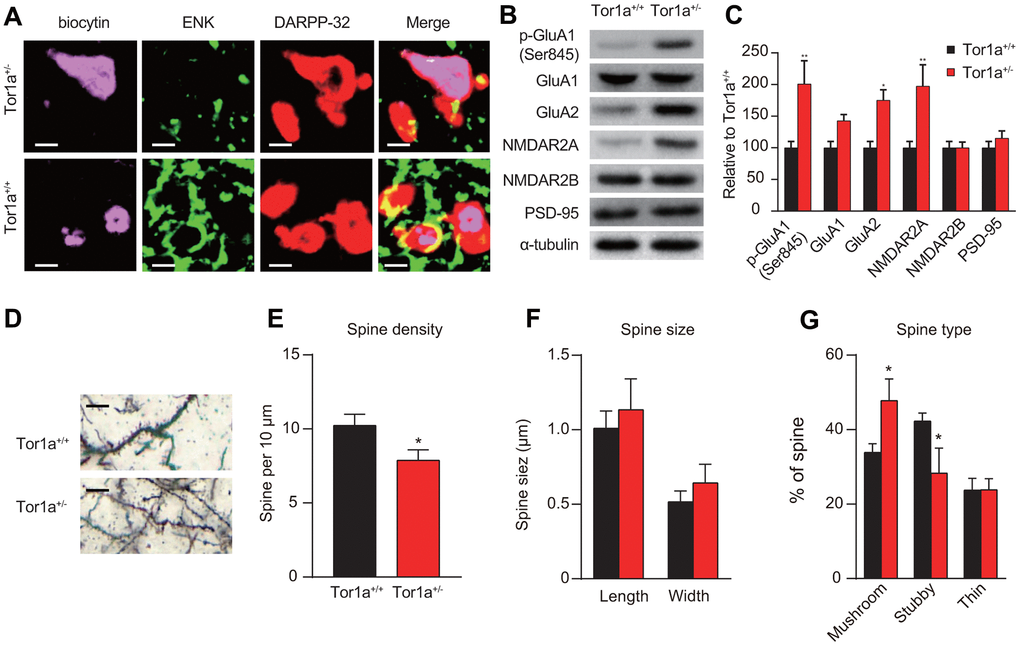 Altered molecular markers and morphology of synapse in Tor1a+/- mice. (A) Representative confocal images from two SPNs recorded in Tor1a+/- and Tor1a+/+ slices (scale bar: 10 μm). Recording electrodes were filled with biocytin (pink) and SPNs were immunolabelled with anti-ENK (green) and anti-DARPP-32 (red). ENK-negative SPNs from Tor1a+/- slices failed to induce LTD. (B) WB analysis for p-GluA1 (Ser845), GluA1, GluA2, NMDAR2A, NMDAR2B, PSD-95 and α-tubulin in Tor1a+/- and age-matched Tor1a+/+ mice. (C) Histogram showed the quantification of protein levels following normalization on α-tubulin in Tor1a+/- and age-matched Tor1a+/+ mice. All values are mean ± SEM expressed as % of Tor1a+/+ mice. (D) Representative images showed spine morphology of Tor1a+/- and age-matched Tor1a+/+ mice (scale bar: 10 μm). (E) Histogram represented dendritic spine density in Tor1a+/- and Tor1a+/+ SPNs. Tor1a+/- SPNs exhibited an overall decrease of dendritic spine density (PF, G) Histograms showed the quantification of dendritic spine size (F, spine length and head width) and dendritic spine type (G, mushroom, stubby, thin) in Tor1a+/- and age-matched Tor1a+/+ mice. A larger number of mushroom-type spines and a concomitant smaller number of stubby-type spines were found in Tor1a+/- SPNs (both PP