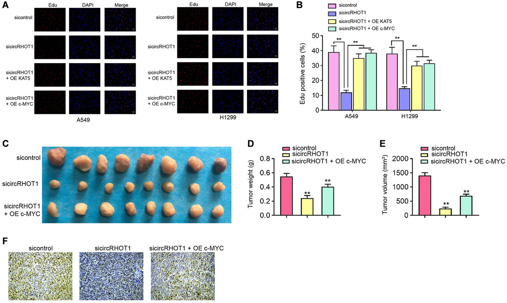 CircRHOT1/c-MYC signaling contributes NSCLC cell proliferation in vitro and in vivo. (A and B) The A549 and H1299 cells were treated with circRHOT1 siRNA or co-treated with circRHOT1 siRNA and KAT5 overexpression vector or c-MYC overexpression vector. The cell survival was detected by Edu assays. (C–F) The nude mice (n = 5) were injected with A549 cells treated with circRHOT1 siRNA or co-treated with circRHOT1 siRNA and c-MYC overexpression vector. The tumor image (C), tumor weight (D), and tumor volume (E) were shown. (F) The Ki-67 levels were analyzed by IHC staining. mean ± SD, **P 