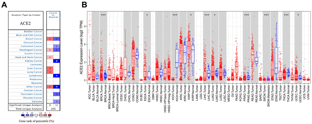 The expression levels of ACE2 in different cancers. (A) ACE2 in breast cancer compared to normal tissues in the Oncomine database. (B) ACE2 expression level of breast cancer and its different subtype in the TCGA database were detected by TIMER (*p