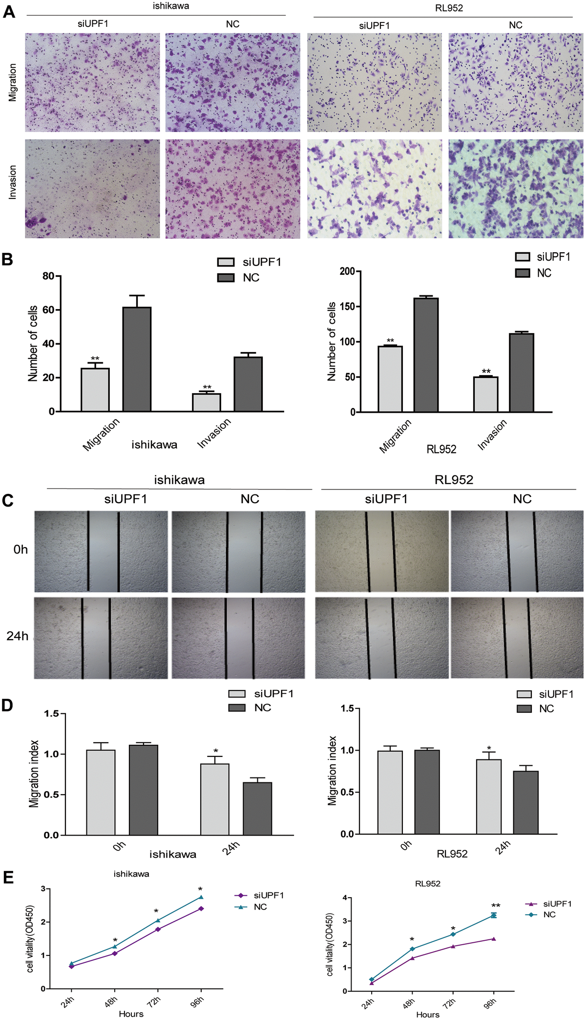 The effect of UPF1 on cell migration, invasion and proliferation in Ishikawa and RL952 EEC cells. (A, B) Migration and invasion assay in Ishikawa and RL952 cells that were transfected with siUPF1 and NC. Cells were evaluated at 24h after transfection(NIKON,100X). The results are shown as the mean±SEM from two independent experiments(**PC, D) Wound healing assay showing cell migration in Ishikawa and RL952 cells(*pE) CCK8 assay showing cell proliferation in Ishikawa and RL952 that were transfected with siUPF1 and NC(*p