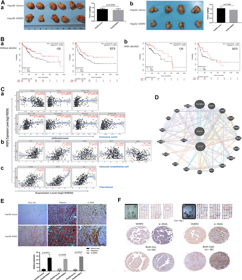 Upregulation of WISP2 is related to tumour purity, and the infiltration of fibroblasts into HCC tissues exerts a negative role in HCC progression. (A, a) In nude mouse models, subcutaneous tumour weights did not differ in mice injected with Hep3B-WISP2 and Hep3B-Vector. (A, b) Subcutaneous tumour weights also did not differ in mice injected with HepG2-WISP2 and HepG2-Vector. (B, a, b) Higher expression of WISP2 were acting as a protective factor, especially in HCC patients without alcohol intake. (C) WISP2 expression was significantly negatively correlated with tumour purity (a), and was significantly correlated with the specific marker of vascular endothelial cells (b) and fibroblast (c) in TIMER database. (D) The interactions between WISP2 and ACTA2 were evaluated using GeneMANIA database. (E) Increased numbers of fibroblasts and fibro-collagen deposition were positive correlated with the expression of WISP2 in HCC. (F) Human liver cancer tissue microarrays confirmed a positive correlation between WISP2 and α-SMA.