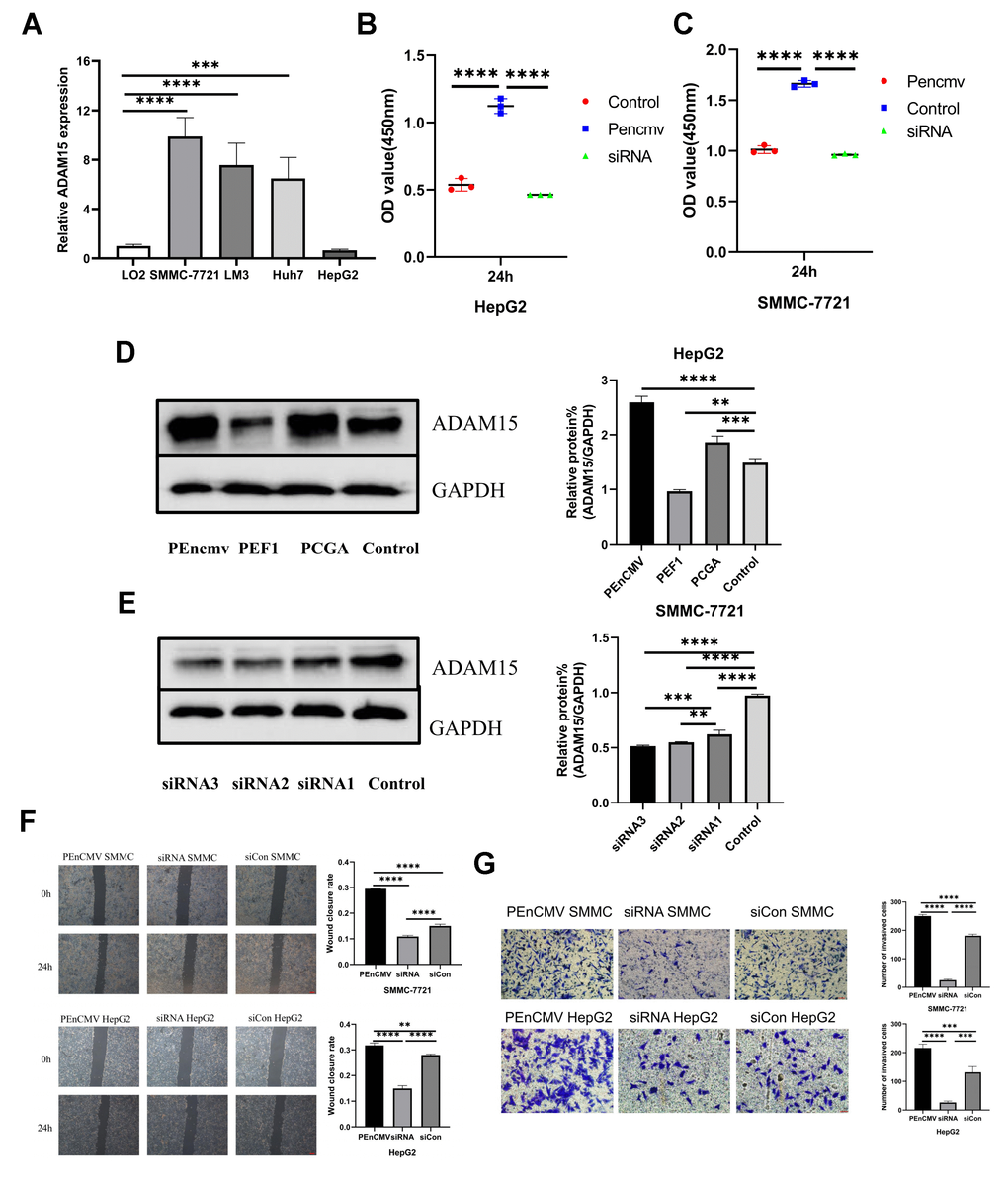 The level of ADAM15 expression was associated with the proliferation, migration and invasion of HCC cells. (A) Comparison of ADAM15 expression in HCC cells and liver cells. (B, C) Cell proliferation ability of HepG2 and SMMC-7721 cell in siCon group, siADAM15 group and ADAM15 overexpression group was examined by CCK8 assay. (D) Overexpression of ADAM15 was evaluated by western blot in HepG2 cell. (E) ADAM15 knockdown was assessed by western blot in SMMC-7721 cell. (F) Cell migration ability of HepG2 and SMMC-7721 cell in siCon group, siADAM15 group and ADAM15 overexpression group was examined by a wound-healing method. Magnification, x40. Scale bar: 200 μm (G) Cell invasion ability of HepG2 and SMMC-7721 cell in siCon group, siADAM15 group and ADAM15 overexpression group was evaluated by transwell assay. Magnification, x200. Scale bar: 50 μm.