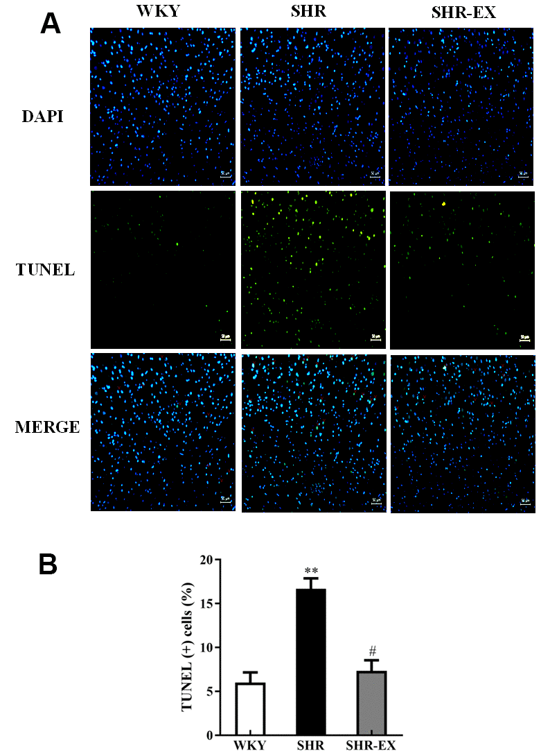 (A) Positive apoptotic neural cell was identified with 4′,6-diamidino-2-phenylindole (DAPI) staining and terminal deoxynucleotidyl transferase dUTP nick end labeling (TUNEL) assay. The upper image with blue spots indicates DAPI staining, middle image with green spots indicates TUNEL assay, and lower image with blue and green spots indicates Merge of DAPI staining and TUNEL assay. Scale bar, 50μm. (B) The bar shows the quantification of TUNEL apoptosis (%), determined as the proportion of TUNEL-positive cells relative to total DAPI stained nuclei. **: pp