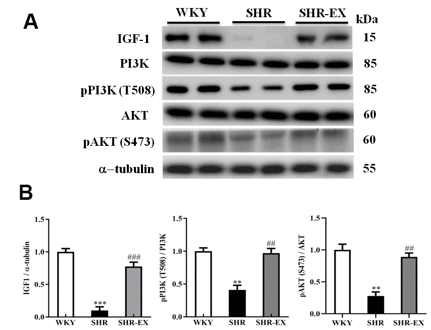 The IGF-1-related survival pathway in a normotensive Wistar Kyoto (WKY) group, a spontaneously early aged hypertensive (SHR) group and a hypertension with 12 weeks exercise training (SHR-EX) group. (A) The representative protein levels of IGF-1, PI3K, p-PI3K, AKT and p-AKT protein extracted from the cerebral cortex of excised brain in WKY, SHR, and SHR-EX groups were measured by western blot analysis. The α-tubulin was used as an internal control. (B) Bars represent the relative changes of protein quantification in IGF-1, p-PI3K/PI3K, and pAKT/AKT on α-tubulin and mean values ± SD (n=6 in each group). **: pppp