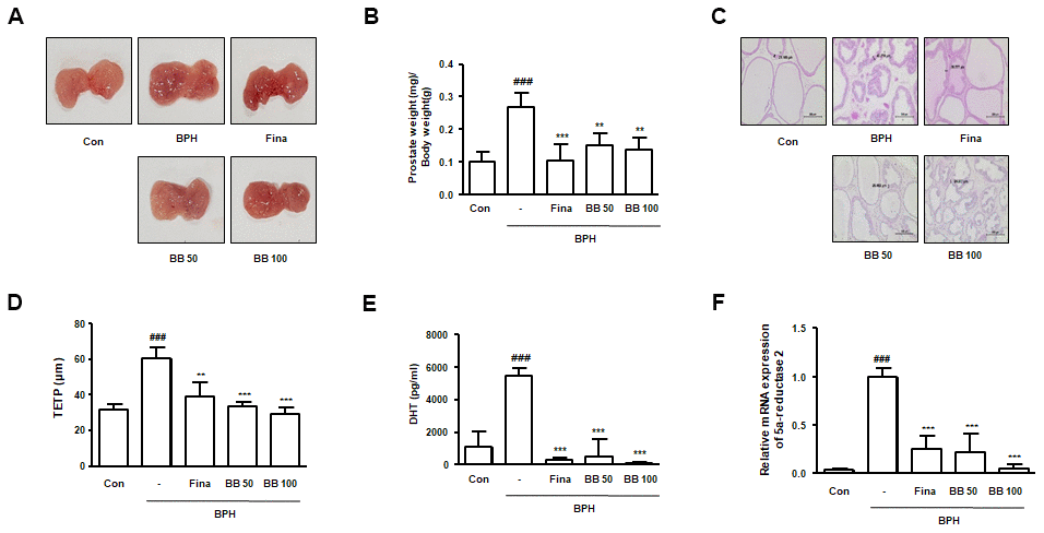 Effects of BB on prostate gland enlargement via androgen-dependent manner in testosterone-induced BPH rat model. The animals were randomly divided into five groups: Con group, BPH group (testosterone-induced BPH rats), Fina group (testosterone-induced BPH rats administered with Fina 5mg/kg), BB 50 group (testosterone-induced BPH rats administered BB 50 mg/kg), and BB 100 group (testosterone-induced BPH rats administered BB 100 mg/kg). (A) Representative photograph of prostate tissues from the testosterone-induced BPH rat model. (B) The prostate weight-to-body weight ratio was estimated. (C) Histopathological analysis was conducted using H&E. Original magnification 100×. (D) Based on histological analysis, the level of TETP was measured and represented. (E) Serum DHT levels were determined using an ELISA kit. (F) The mRNA level of 5α-reductase 2 was quantified using qRT-PCR analysis. ### P 